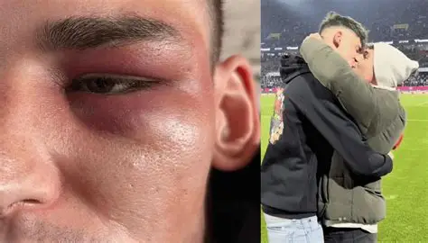 Aggredito Kaiser, l’arbitro protagonista della proposta di matrimonio